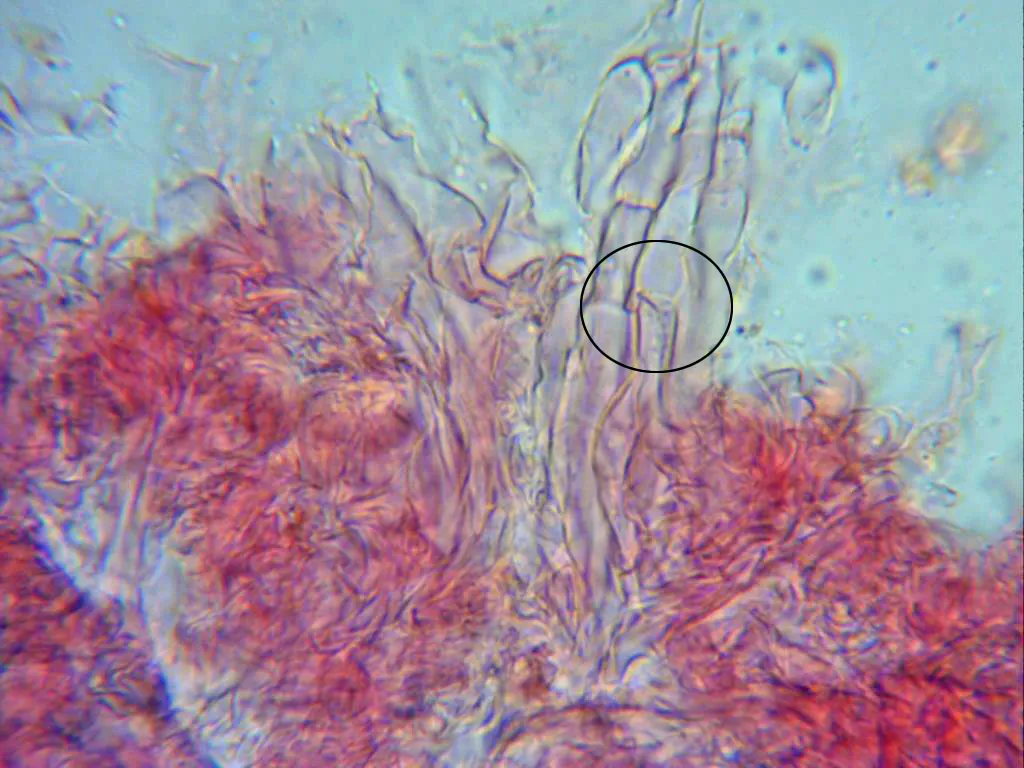 Microscopía de Rimbachia bryophila - 3